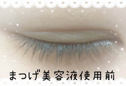 スカルプDボーテ ピュアフリーアイラッシュセラム プレミアムクイーン/アンファー(スカルプD)/まつげ美容液を使ったクチコミ(2枚目)