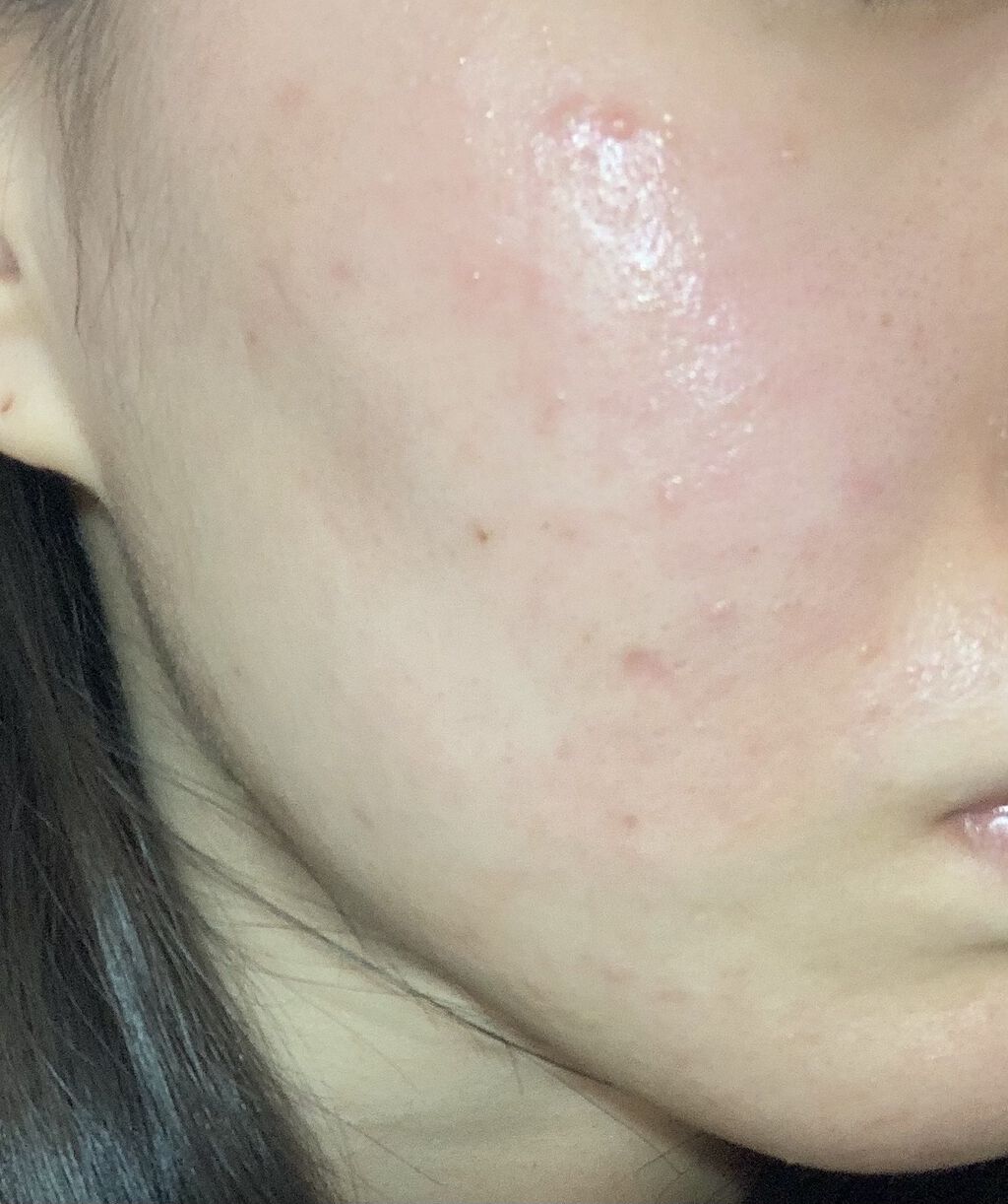 ドクタージャルト シカペア クリーム （第2世代）/Dr.Jart＋/フェイスクリームを使ったクチコミ（3枚目）