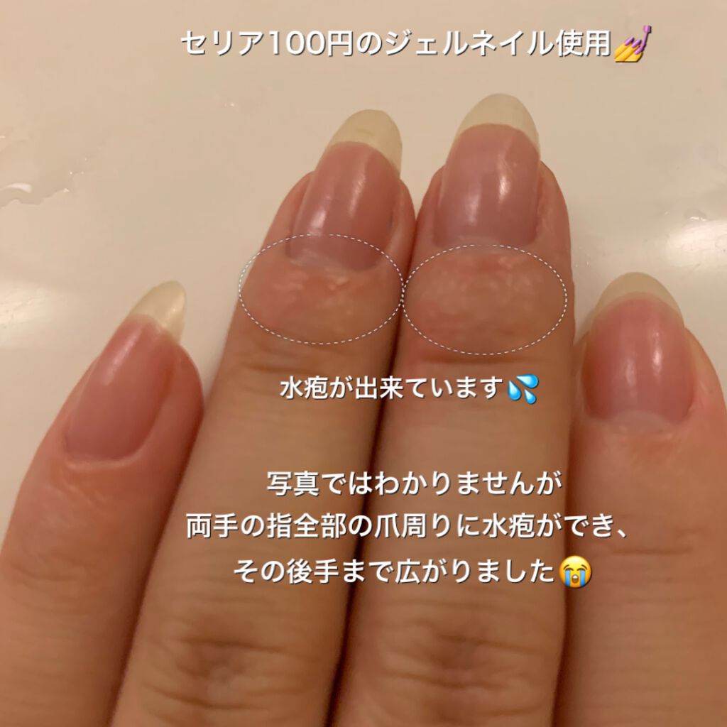 ジェルネイル（ライト対応）/セリア/ジェルネイルを使ったクチコミ（2枚目）