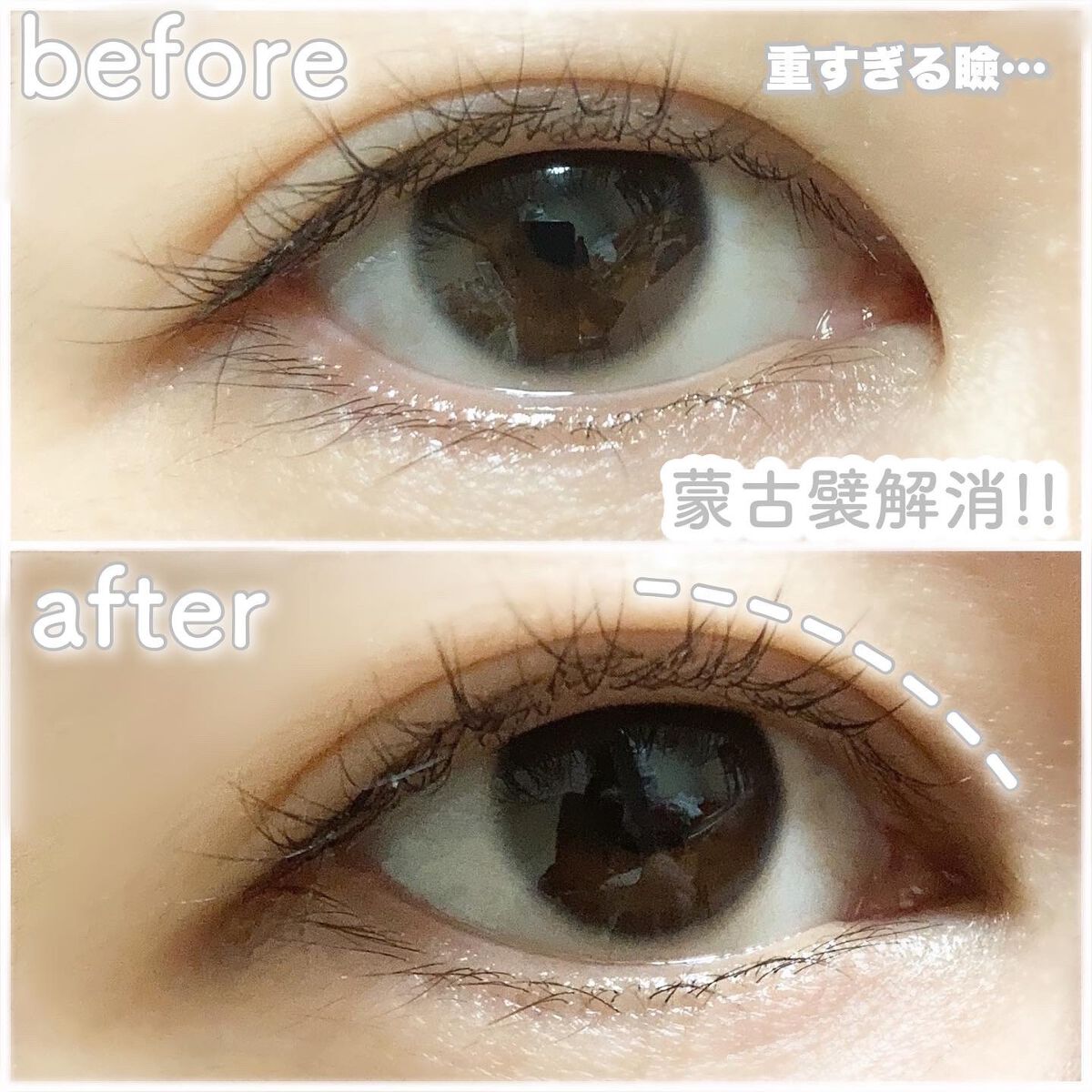 メザイク クリップ カッター ファイバー専用カッター/メザイク/二重まぶた用アイテムを使ったクチコミ(3枚目)