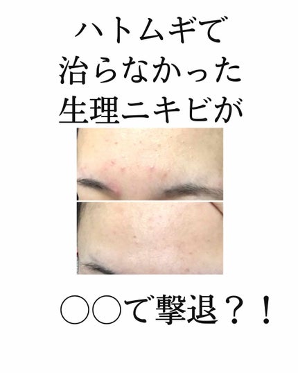 ロゼット洗顔パスタ 海泥スムース/ロゼット/洗顔フォームを使ったクチコミ(1枚目)