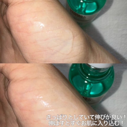 Kara on LIPS 「CNP様よりご提供いただきました。CNP❤︎ダーマアンサーアゼ..」(4枚目)