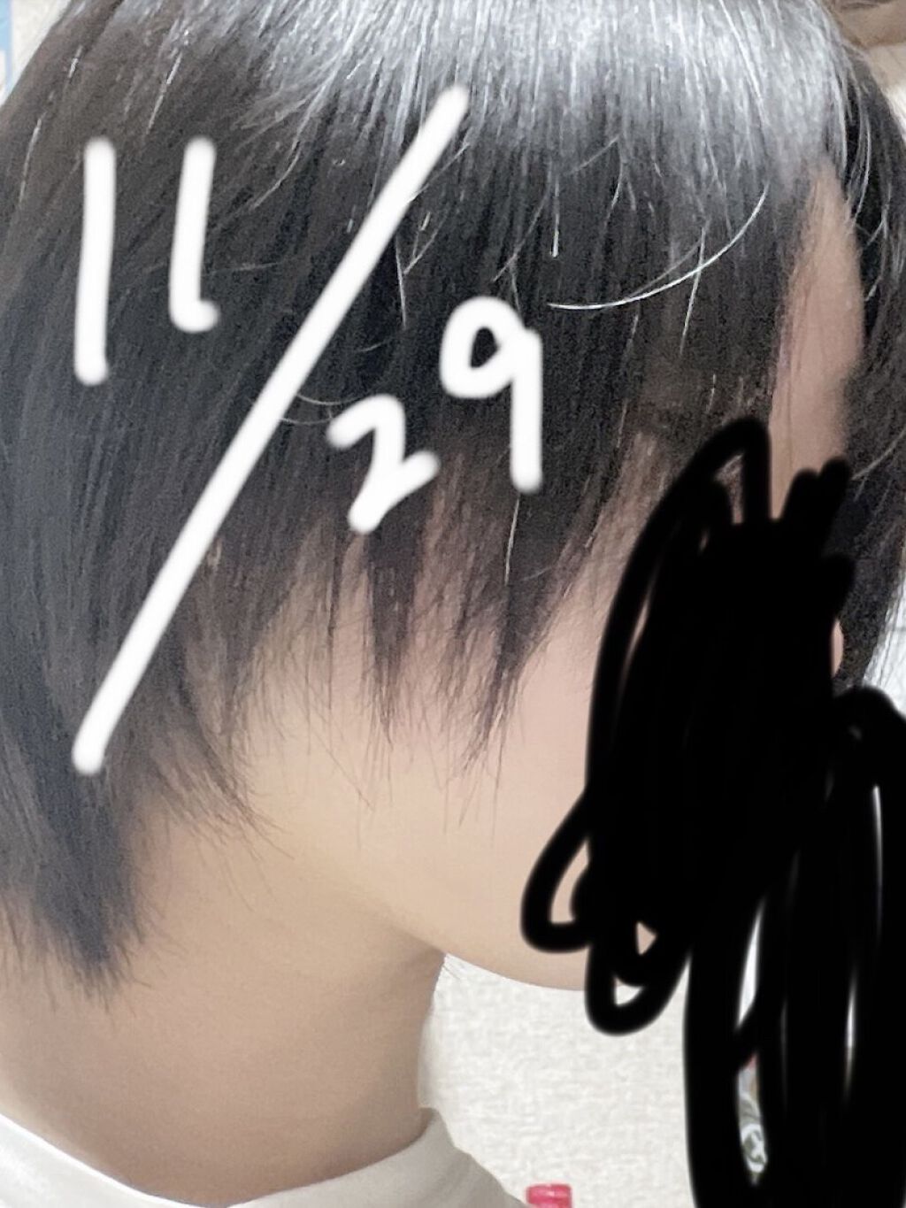 ヘアアクセルレーターEX フローラルアップルの香り/加美乃素本舗/頭皮ローションを使ったクチコミ（1枚目）