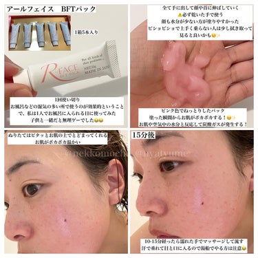 　どんぶらこ♡フォロバ100 on LIPS 「アールフェイスのプロモーションに参加中です▶︎アールフェイス　..」（3枚目）