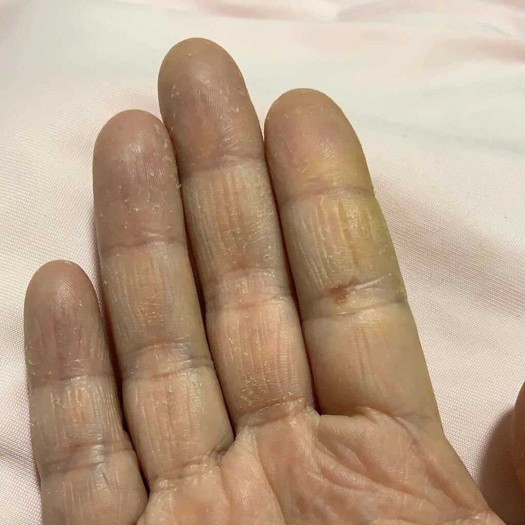 ザーネクリーム/ザーネ/ボディクリームを使ったクチコミ(2枚目)