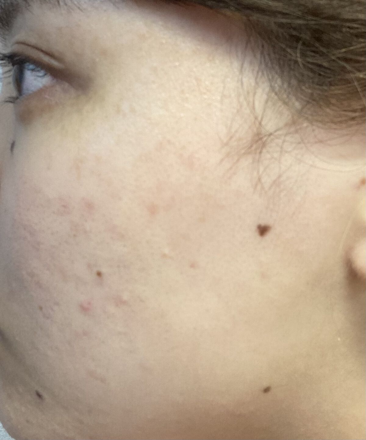 化粧水・敏感肌用・高保湿タイプ/無印良品/化粧水を使ったクチコミ（1枚目）