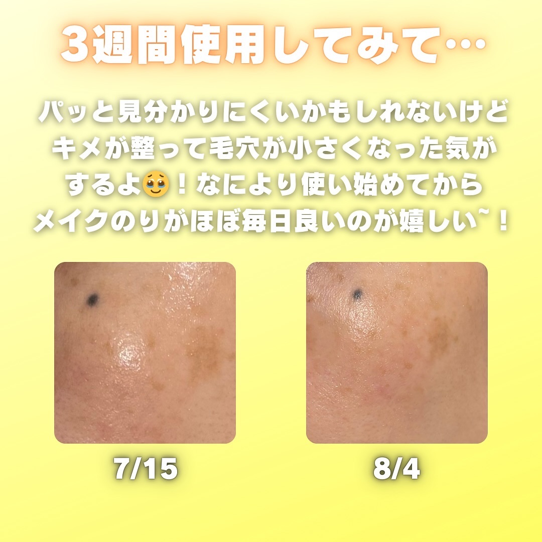 ビタペアC ビタレチ美容液/ネイチャーリパブリック/美容液を使ったクチコミ（2枚目）