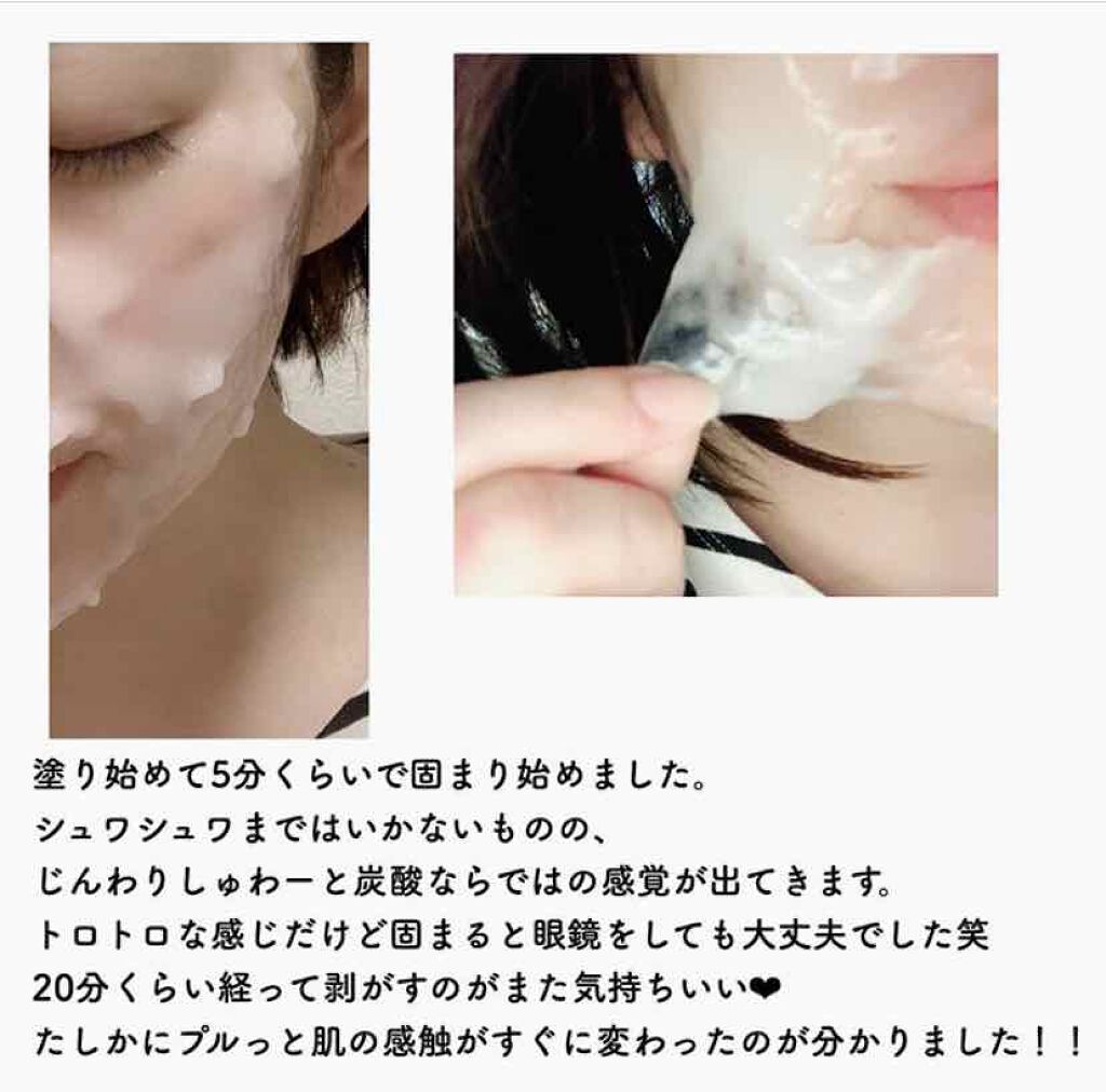 炭酸パック プルリ/ウツクシア/洗い流すパック・マスクを使ったクチコミ(4枚目)