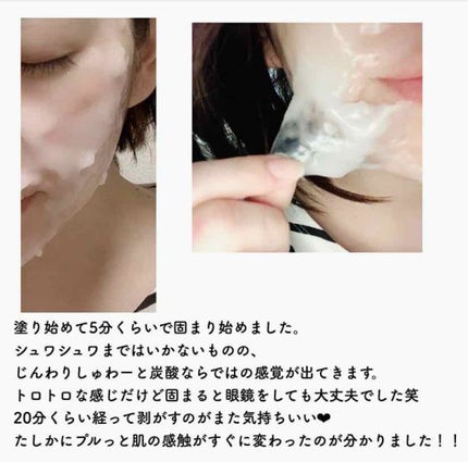炭酸パック プルリ/ウツクシア/洗い流すパック・マスクを使ったクチコミ(4枚目)