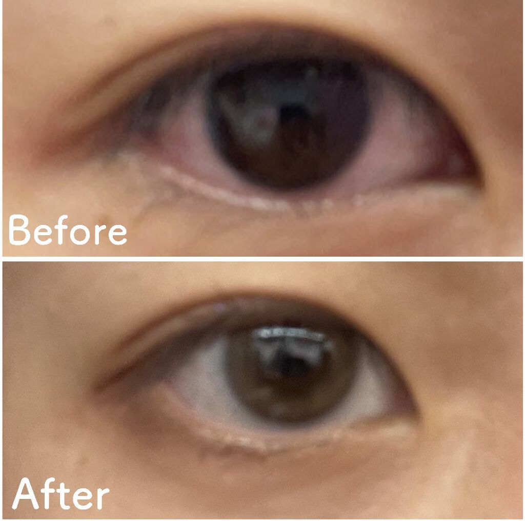 LARME MELTY SERIES(ラルムメルティシリーズ)/LARME/カラーコンタクトレンズを使ったクチコミ（2枚目）