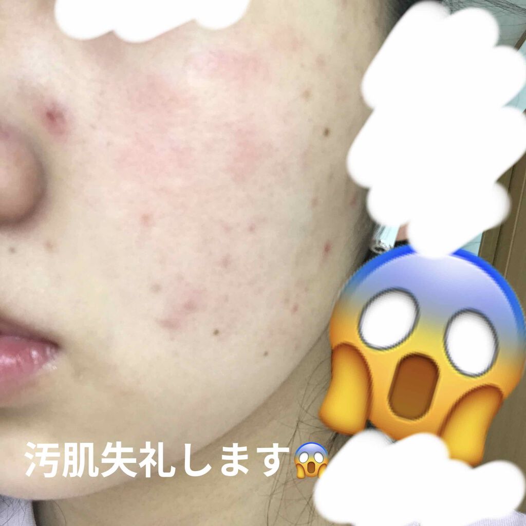 ホットクレンジングゲル/マナラ/クレンジングジェルを使ったクチコミ（2枚目）