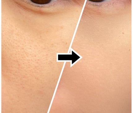 カバーリシャス アルティメット ホワイトクッション/BANILA CO/クッションファンデーションを使ったクチコミ(5枚目)