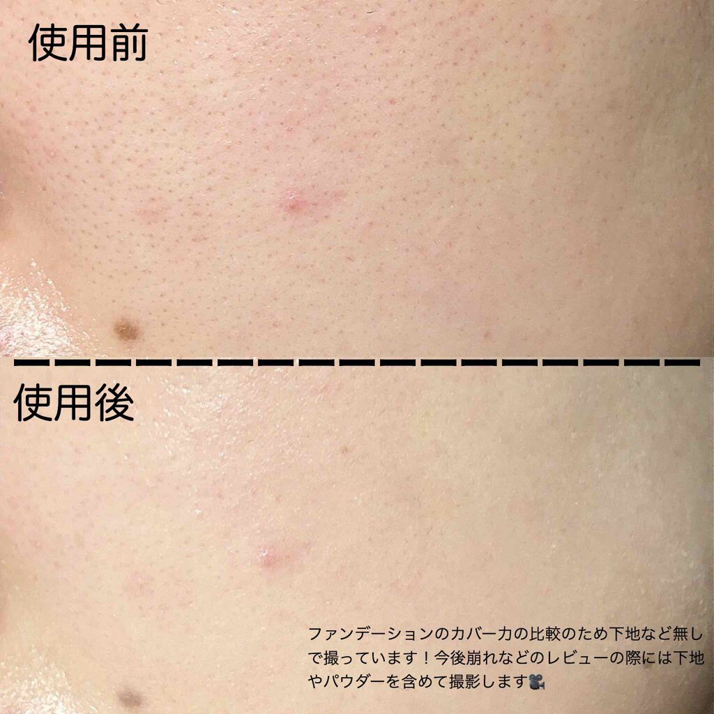THE FIRST CUSHION COVER/MERZY/クッションファンデーションを使ったクチコミ(3枚目)