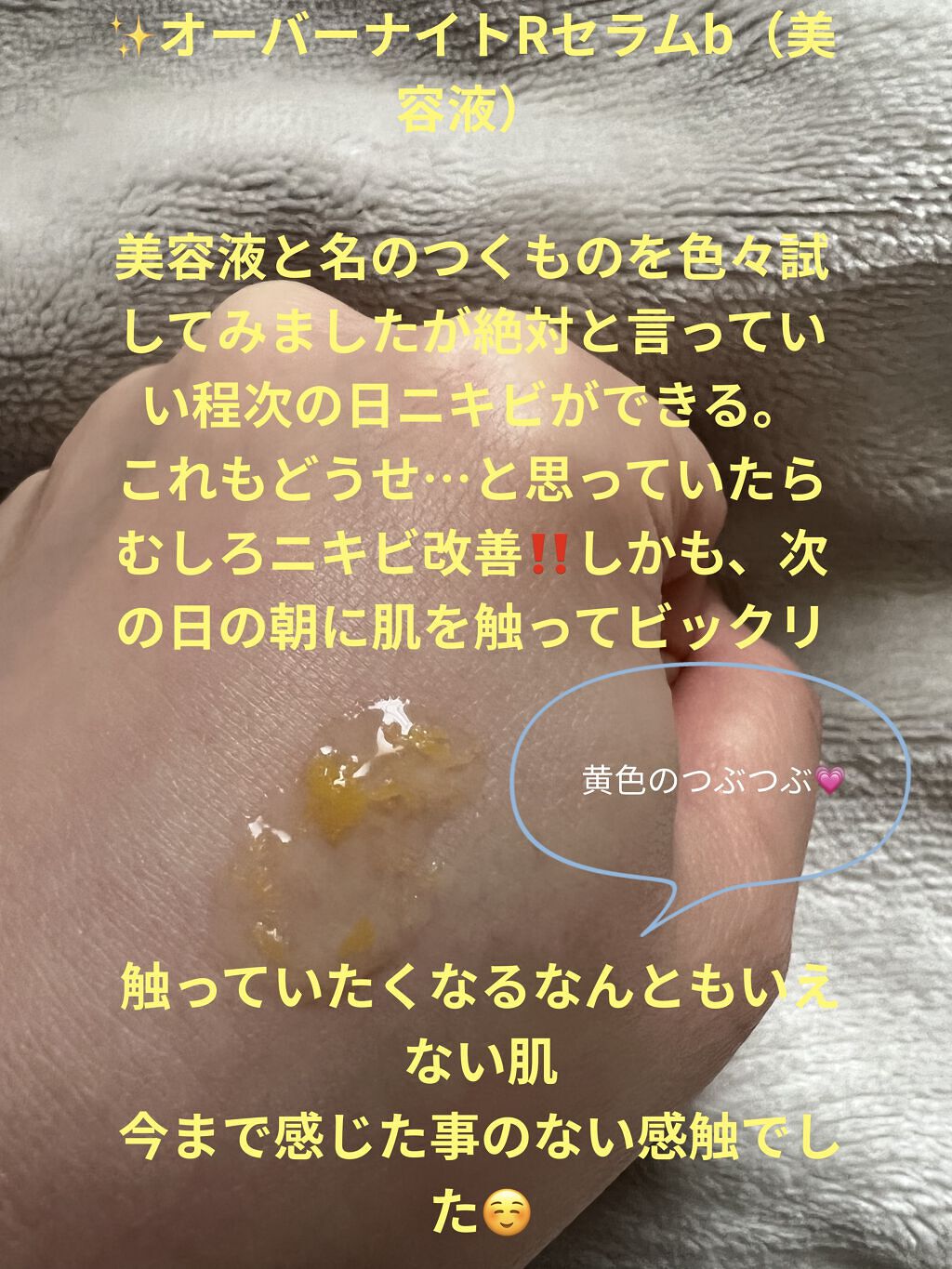 イモーテル リセットトリプルエッセンス 50ml/L'OCCITANE/ミスト状化粧水を使ったクチコミ（2枚目）