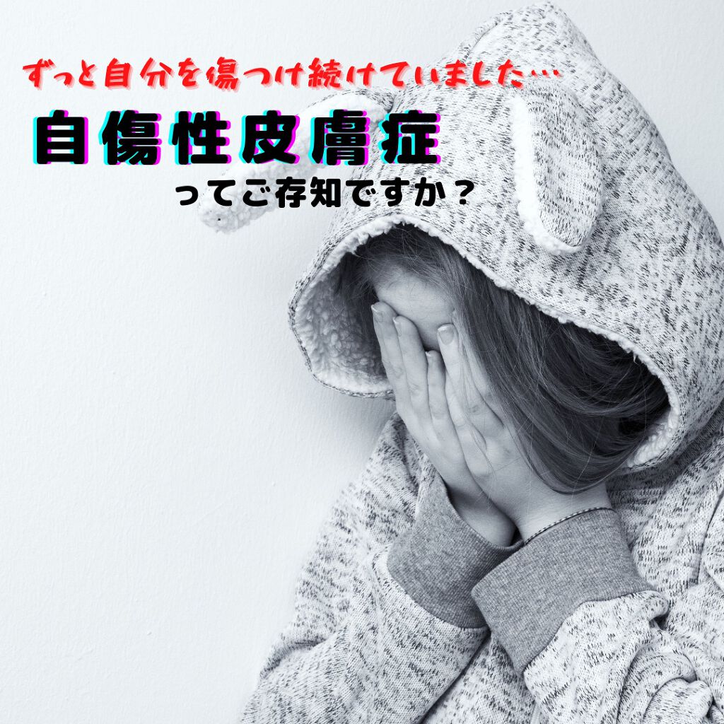 薬用ホワイトニング ハンドクリーム モイストジェル/コエンリッチQ10/ハンドクリームを使ったクチコミ(1枚目)