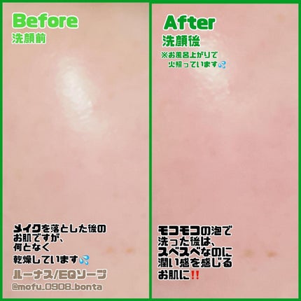 プラケアEQソープ/LUNAS (ルーナス)/ボディ石鹸を使ったクチコミ(8枚目)