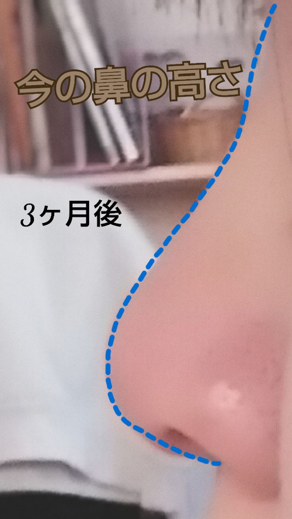 ノーズローラー/DAISO/その他を使ったクチコミ（3枚目）