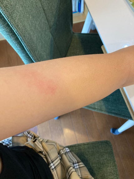 モテ肌 除毛パッド/セリア/ムダ毛ケアを使ったクチコミ(2枚目)