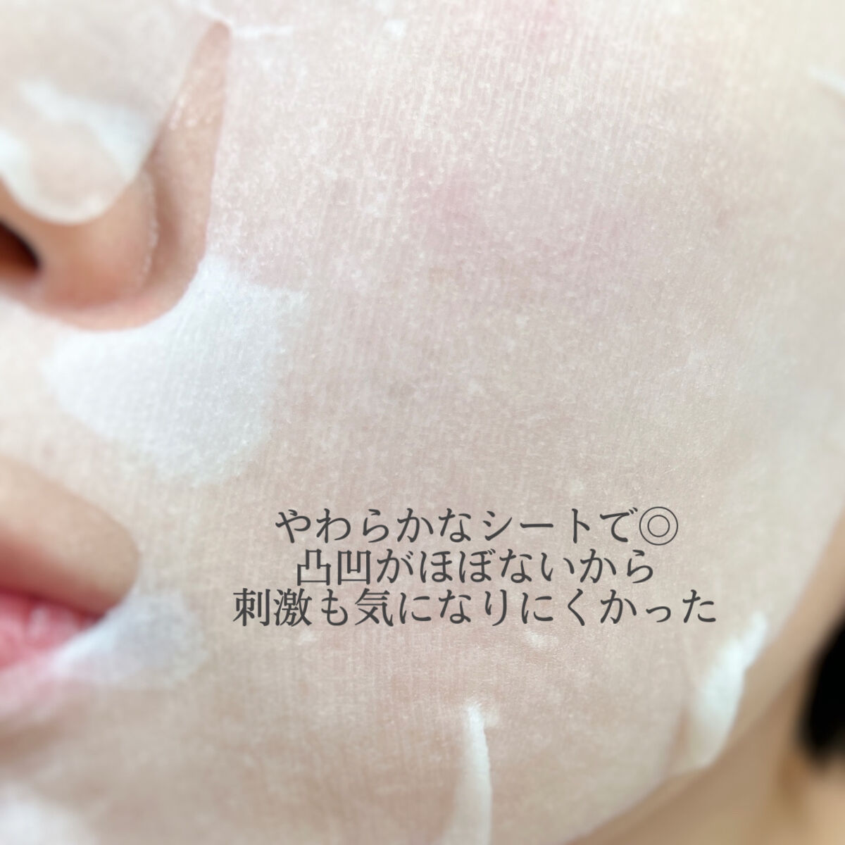 ごめんね素肌 キニナルマスク/クリアターン/シートマスク・パックを使ったクチコミ（3枚目）