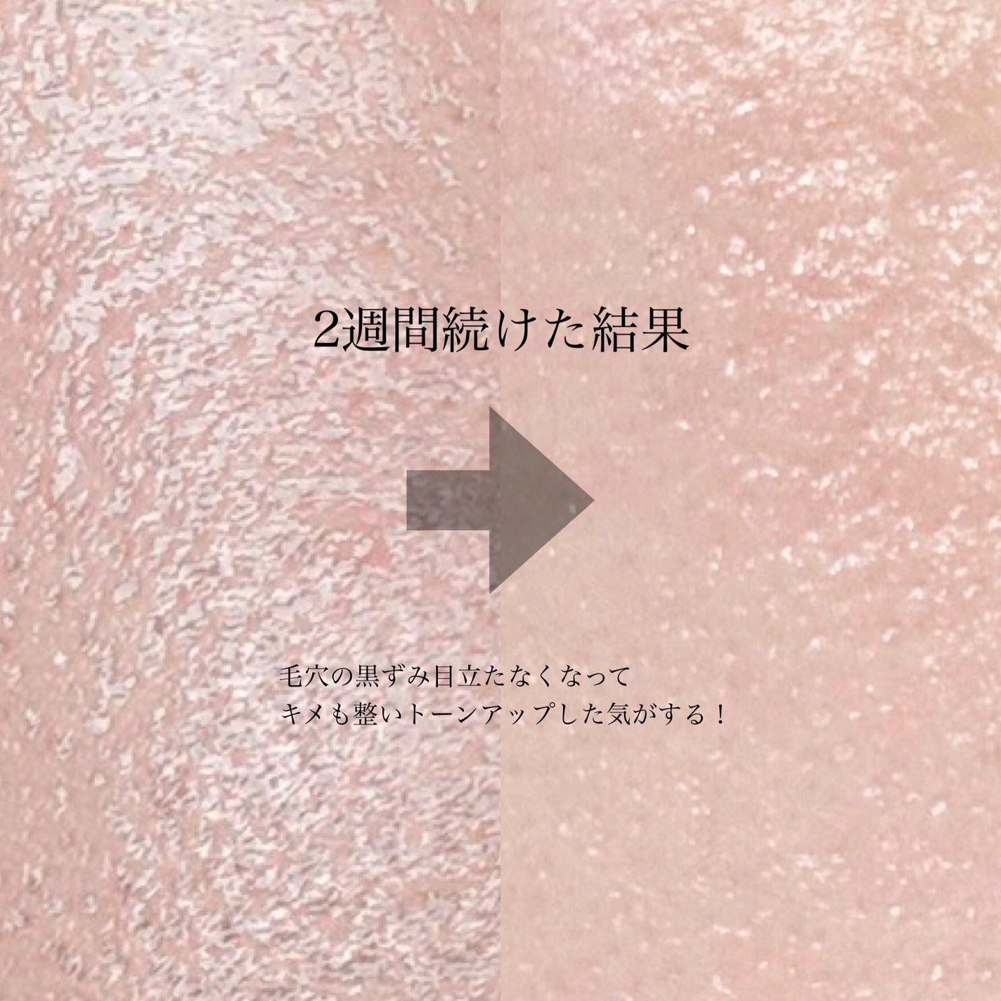 リードルショット300/VT/美容液を使ったクチコミ(8枚目)