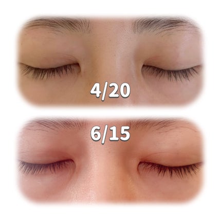 アイラッシュセラム100EX/COSNORI/まつげ美容液を使ったクチコミ(5枚目)