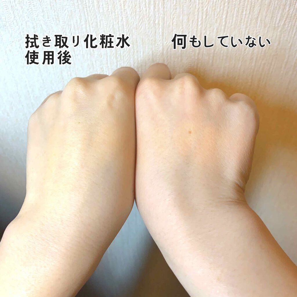 ブランホワイトホワイトニングローションリッチモイスト/BLANC WHITE/化粧水を使ったクチコミ（2枚目）