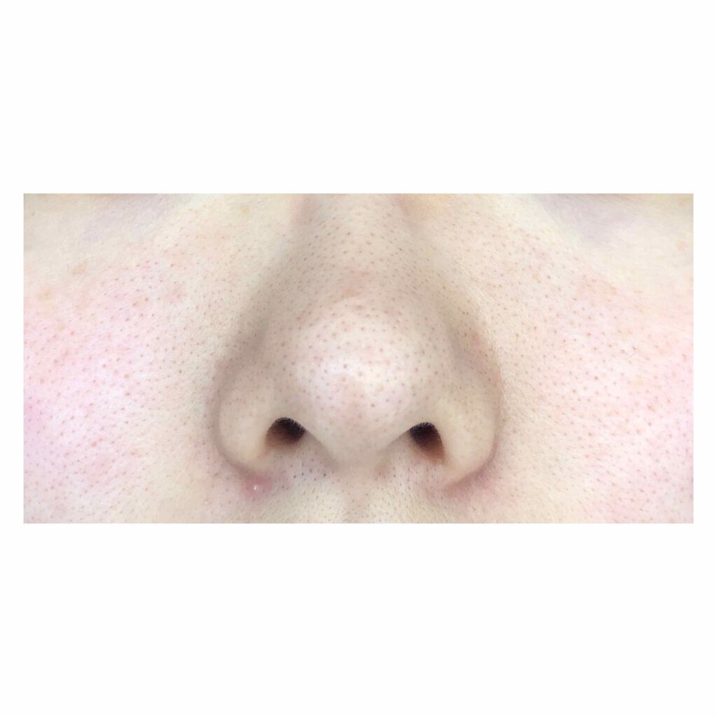 ハトムギ保湿ジェル(ナチュリエ スキンコンディショニングジェル)/ナチュリエ/美容液を使ったクチコミ（2枚目）