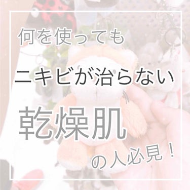 こんにちは！Ricoです＼(^o^)／


今日は、ニキビ治療薬、ニキビに効く化粧水、ニキビに効くスキンケア用品………

これらが全く効かない！治らない！

人、必見の
オススメのスキンケア方法を紹介し