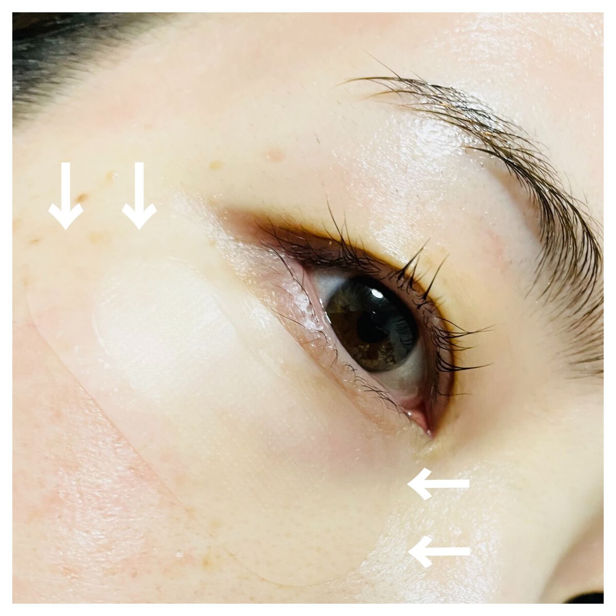 ゴールドコラーゲンニードルパッチ/SNP/アイケア・アイクリームを使ったクチコミ(3枚目)