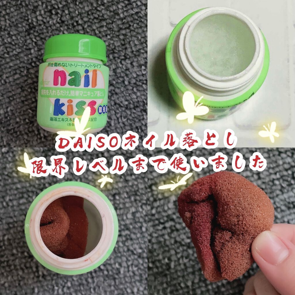 エルファー ネイルキッスA/DAISO/除光液を使ったクチコミ（1枚目）