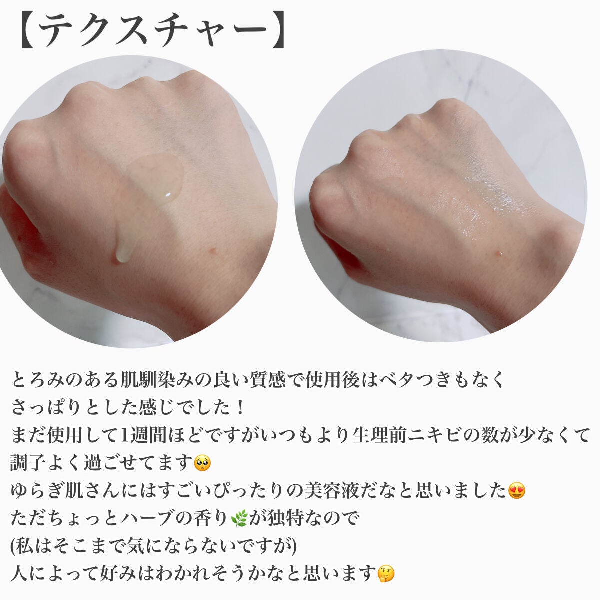 ビフィダシカハーブセラム/manyo/美容液を使ったクチコミ(4枚目)