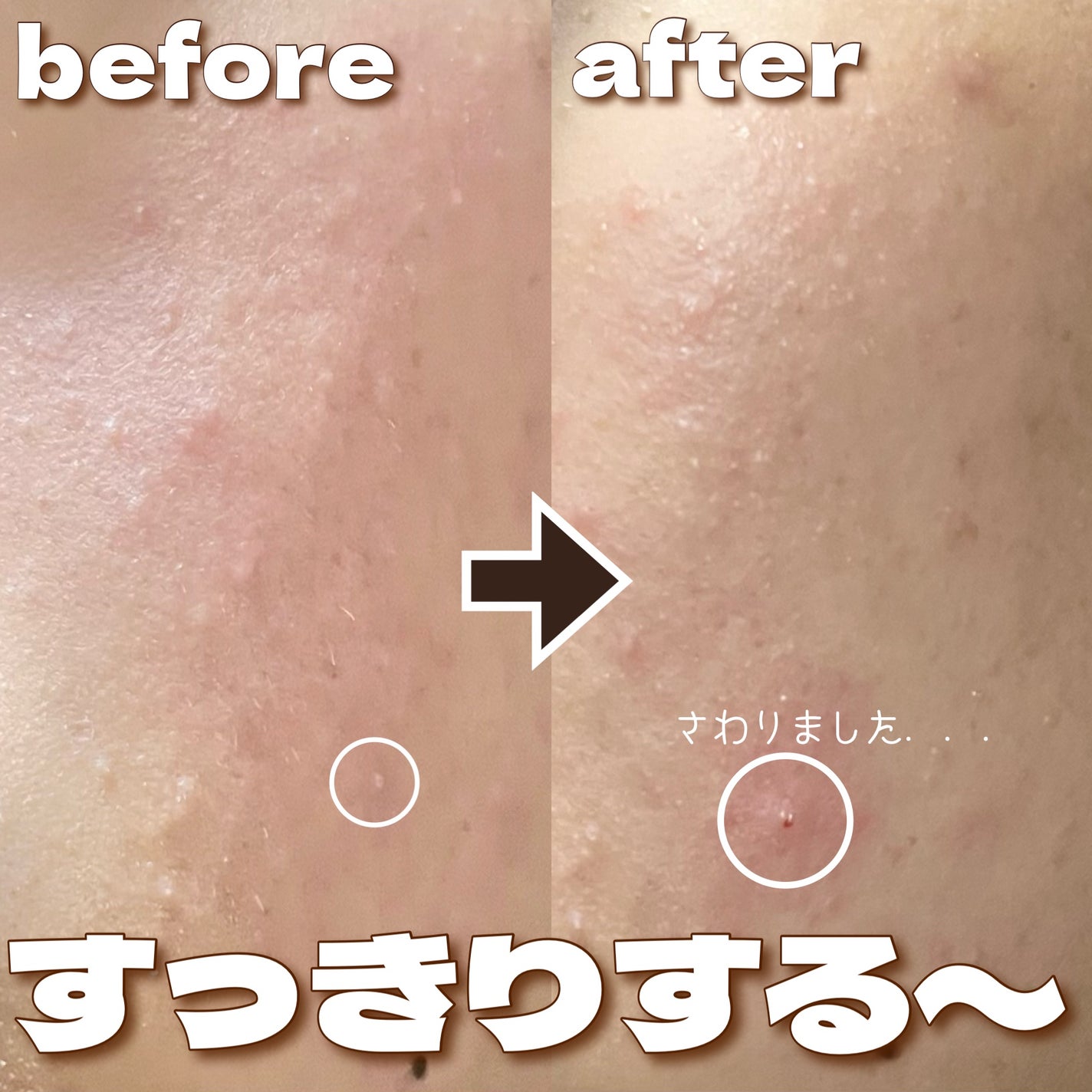 スーパーヴォルカニック ポア クレイマスク/innisfree/洗い流すパック・マスクを使ったクチコミ(6枚目)