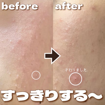 スーパーヴォルカニック ポア クレイマスク/innisfree/洗い流すパック・マスクを使ったクチコミ(6枚目)