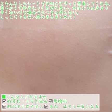 オルフェス センシティブマスク/ALFACE+/シートマスク・パックを使ったクチコミ(6枚目)