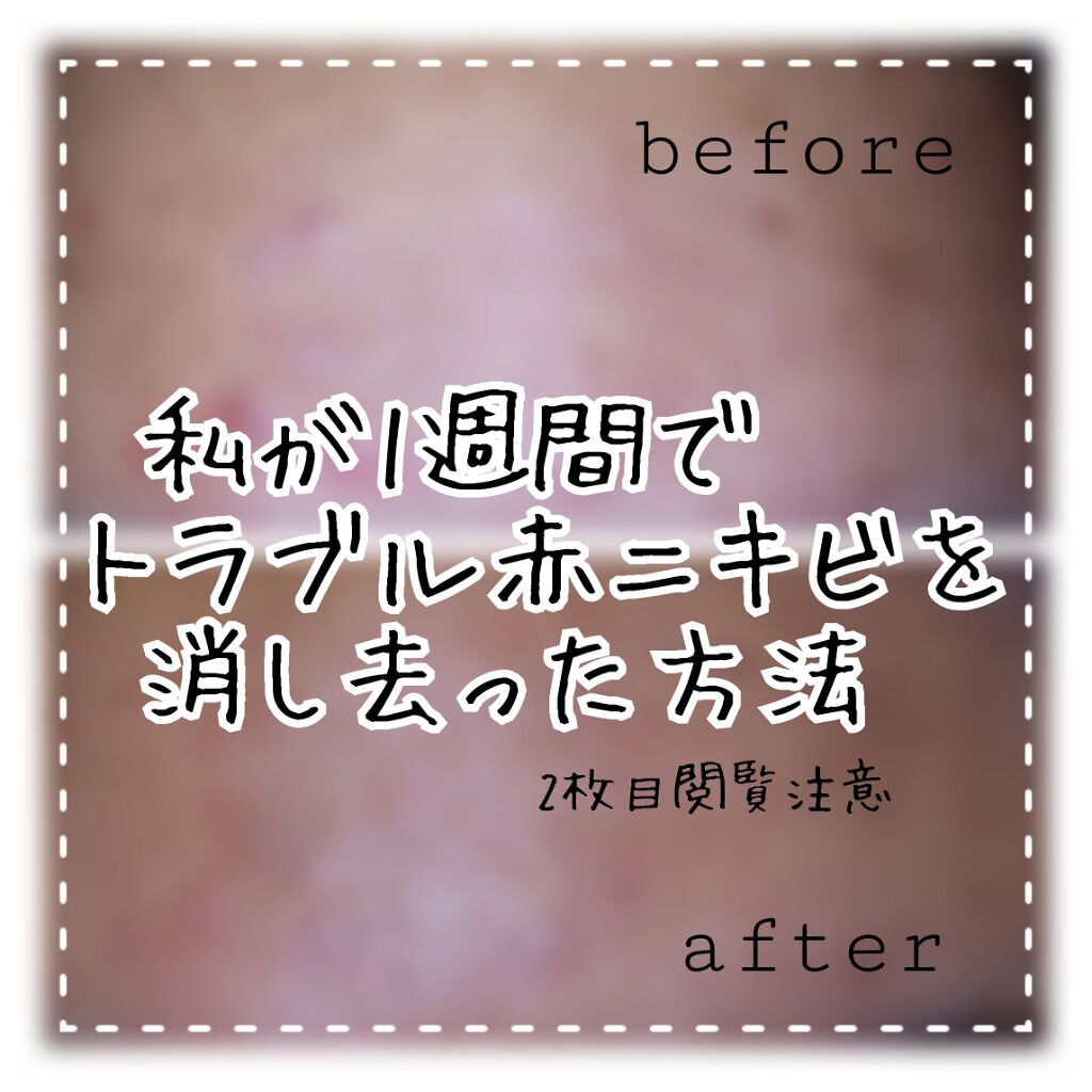 ティーツリーケアソリューション アンプルマスクJEX/MEDIHEAL/シートマスク・パックを使ったクチコミ(1枚目)