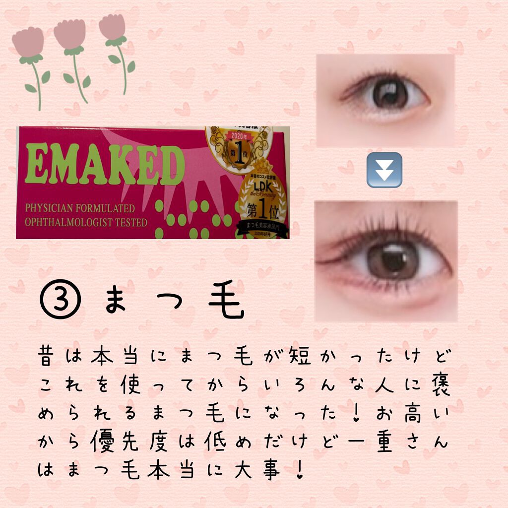 のびーるアイテープ(絆創膏タイプ、レギュラー)/DAISO/二重まぶた用アイテムを使ったクチコミ(4枚目)