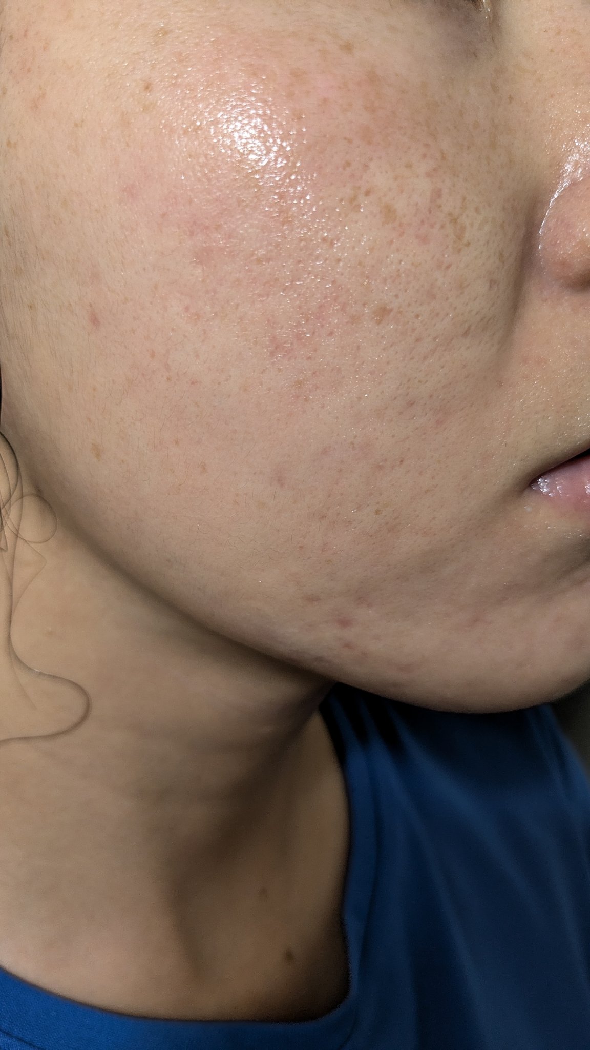 しっとり化粧水 ＮＣ/なめらか本舗/化粧水を使ったクチコミ（1枚目）