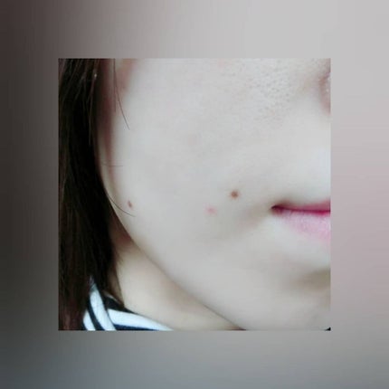 トラブルリペア リキッド/アルージェ/美容液を使ったクチコミ(4枚目)