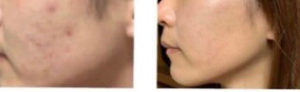 CICARICH シカリッチ フジ フェイシャルマスク/フジ/シートマスク・パックを使ったクチコミ(4枚目)