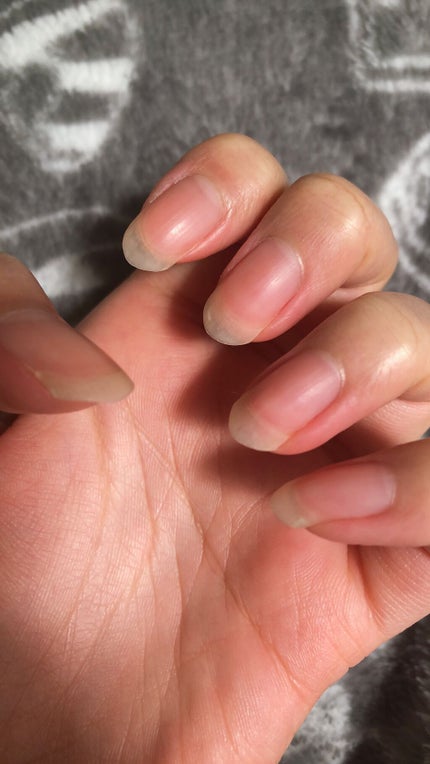 ネイルベッドオイル/アンドネイル/ネイルオイル・トリートメントを使ったクチコミ(1枚目)