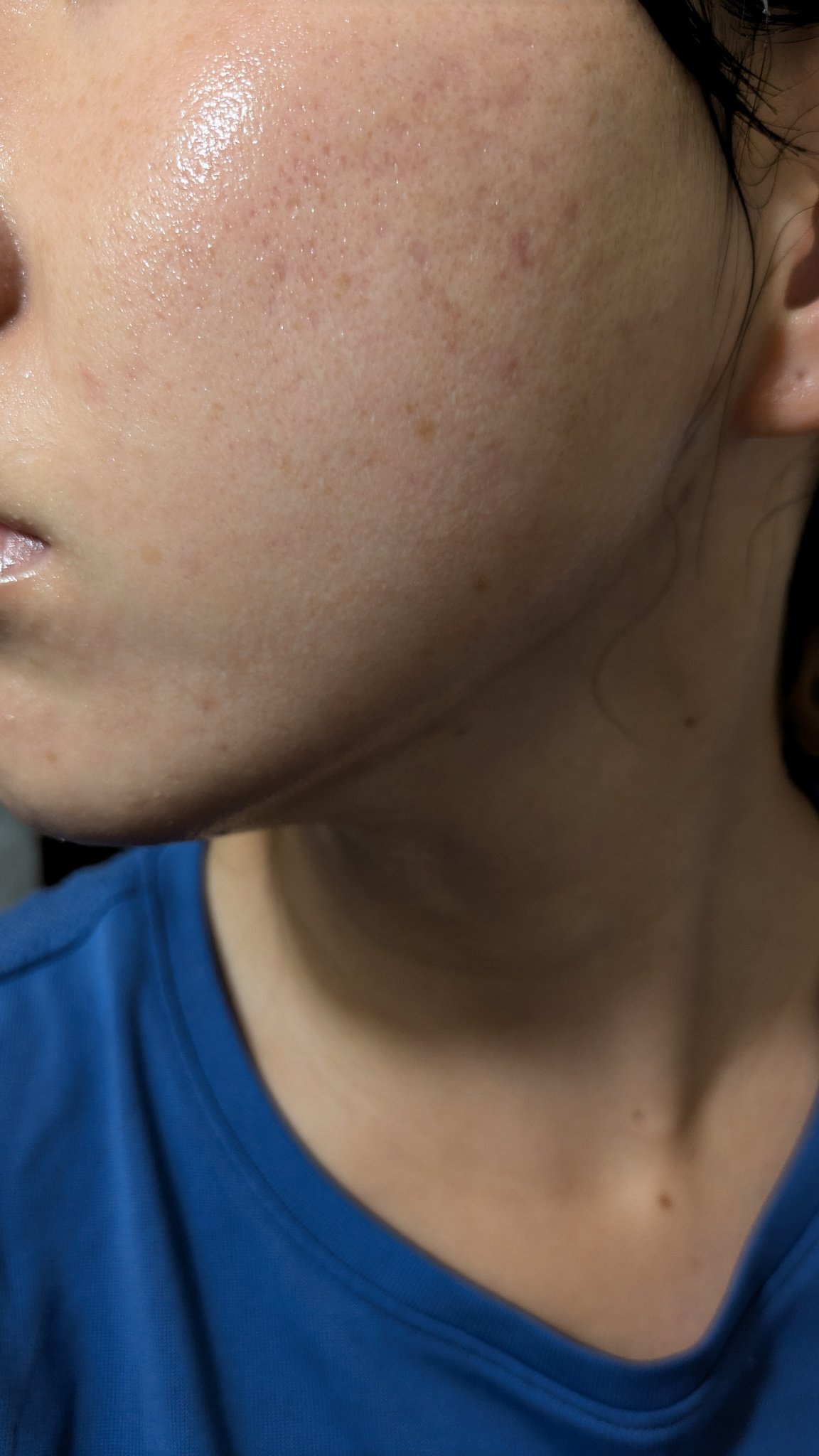 N10+Z1フェイスセラム /The Ordinary/美容液を使ったクチコミ（2枚目）