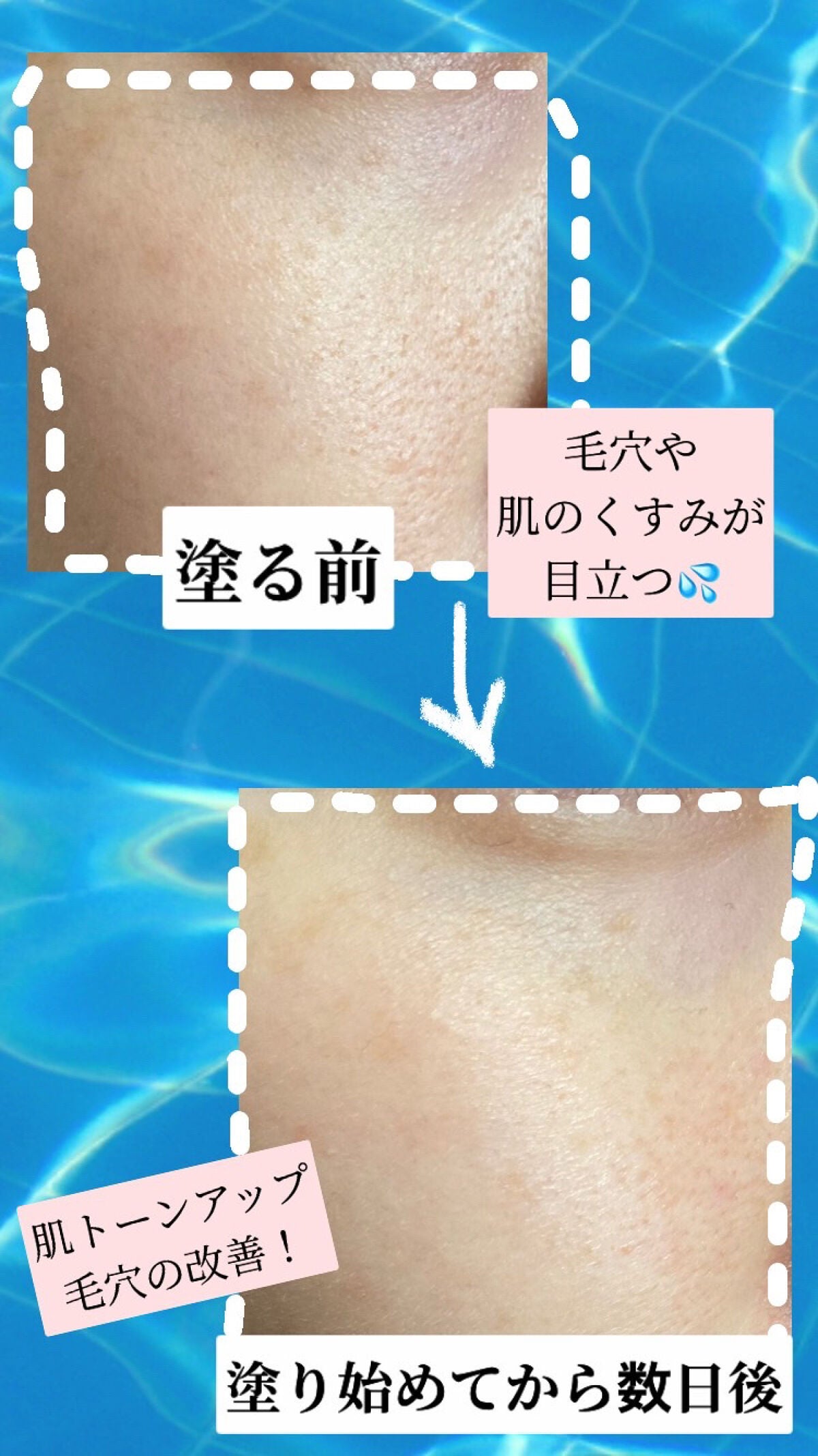 ユース ラディアンス ビタチノール セラム/primera/美容液を使ったクチコミ(5枚目)