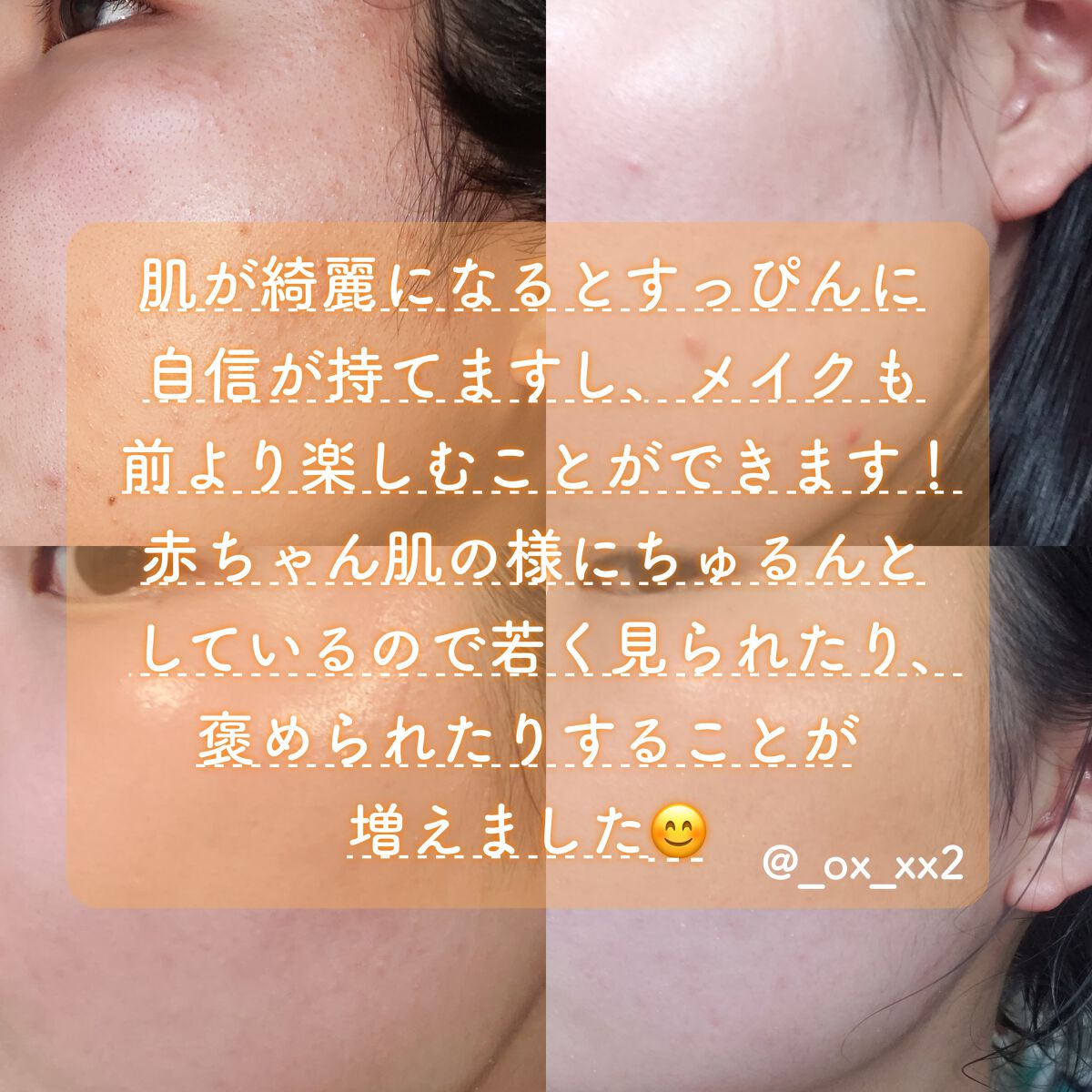 ピュア クレンジング オイル/manyo/オイルクレンジングを使ったクチコミ(5枚目)