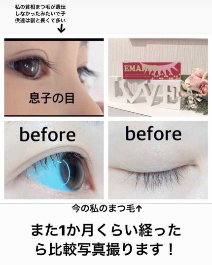 EMAKED(エマーキット)/水橋保寿堂製薬/まつげ美容液を使ったクチコミ(2枚目)
