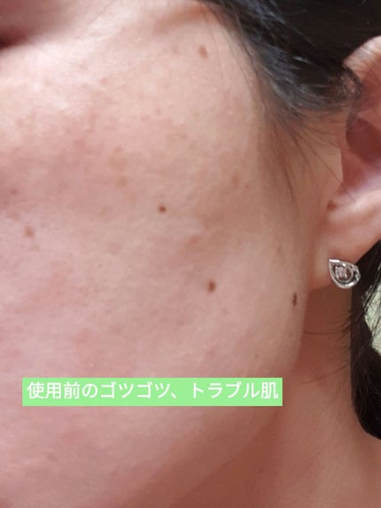 ザビタミンC23/IOPE/美容液を使ったクチコミ(4枚目)