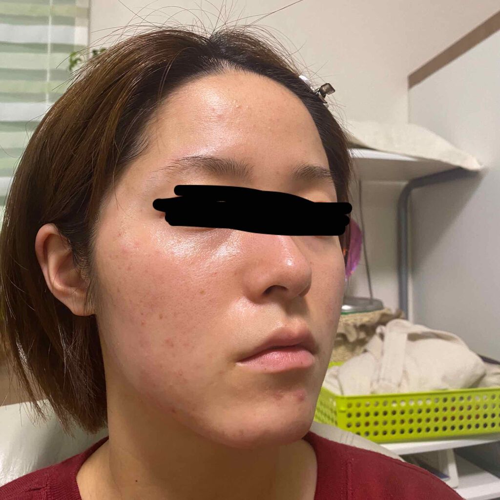 ルルルンプレシャス RED(モイスト)【旧】/ルルルン/シートマスク・パックを使ったクチコミ（2枚目）