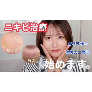 みーきです。 on LIPS 「ニキビ治療はじめました！約1年前から突然、ニキビが頻繁にできる..」（1枚目）