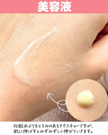 8デイズピュアビタミンCアンプル/VARI:HOPE/美容液を使ったクチコミ(4枚目)