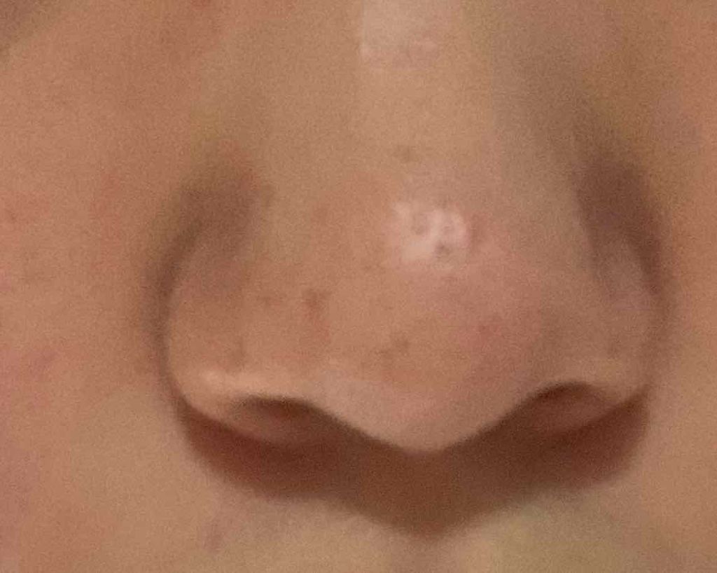 fabulous_make_sivz on LIPS 「小学校の時から鼻の角質や・黒ずみがずっと治らなくて悩んでます色..」(2枚目)