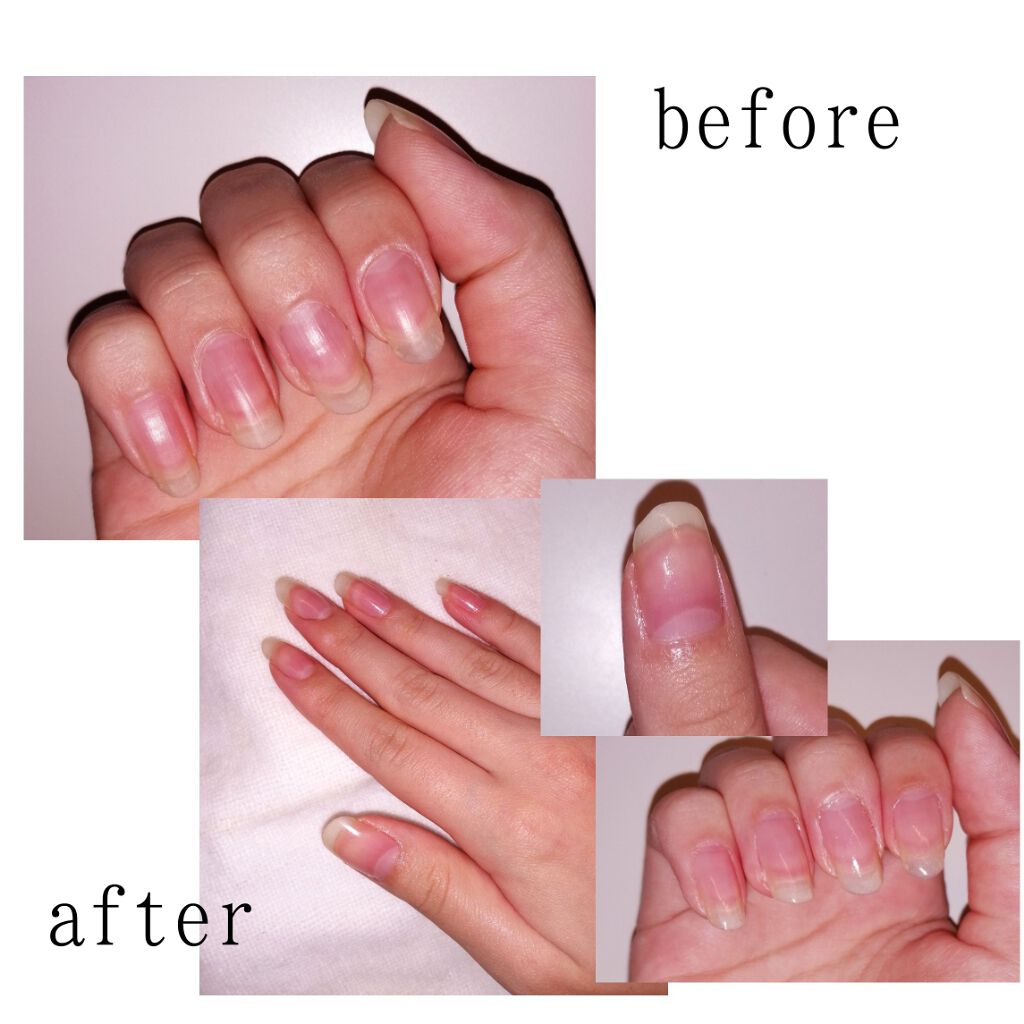 エテュセ クイックケアコート/ettusais/ネイルオイル・トリートメントを使ったクチコミ（2枚目）